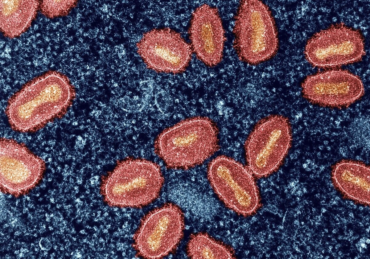 Mpox: com 88 casos em 2026 no Brasil, situação está 'dentro do esperado', afirma especialista