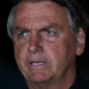 Bolsonaro tem melhora da função renal, mas exames apontam aumento da inflamação