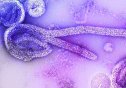 Como o ebola é transmitido e qual o risco para o Brasil?