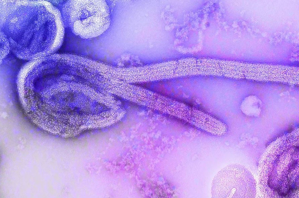 Ebola começou a se espalhar na África possivelmente em funeral há 'alguns meses', diz OMS