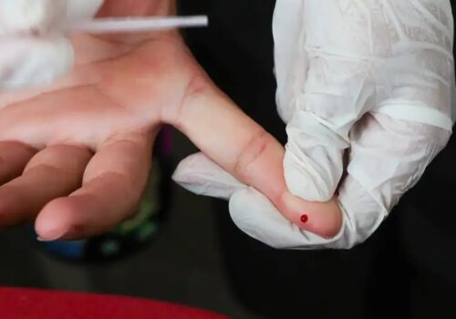 Brasil vai na contramão da tendência global e registra alta de novos casos de HIV