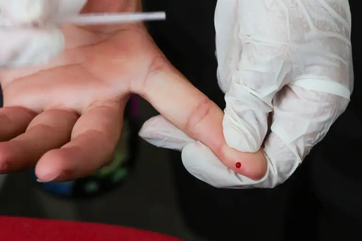 Brasil vai na contramão da tendência global e registra alta de novos casos de HIV